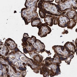 Anti-PROSC antibody produced in rabbit HPA023733-100UL