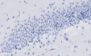 Anti-PROX1 Antibody, clone 1B10 ZooMAb Rabbit Monoclonal 