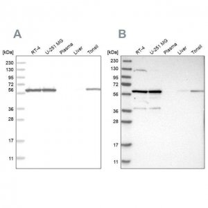 Anti-PRPF4 antibody produced in rabbit 