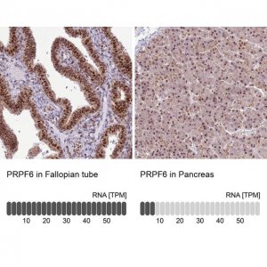 Anti-PRPF6 antibody produced in rabbit 