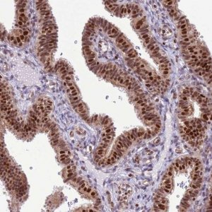 Anti-PRPF6 antibody produced in rabbit 