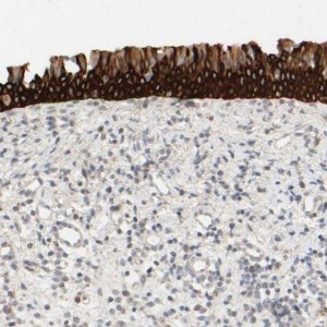 Anti-PRR11 antibody produced in rabbit 