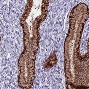 Anti-PRR15 antibody produced in rabbit 