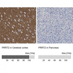 Anti-PRRT2 antibody produced in rabbit 