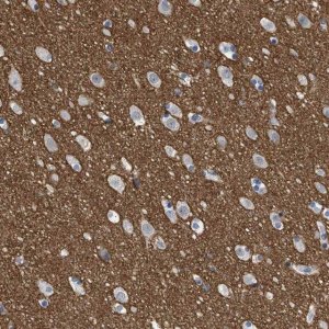 Anti-PRRT2 antibody produced in rabbit 