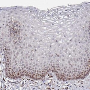 Anti-PRRX1 antibody produced in rabbit 