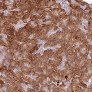 Anti-PRSS42 antibody produced in rabbit HPA046925-100UL