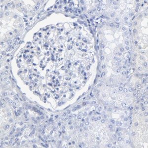 Anti-PSD3 antibody produced in rabbit 