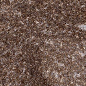 Anti-PSD4 antibody produced in rabbit 