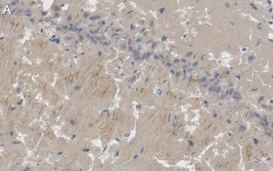 Anti-PSD95 Antibody, clone K28/43 ZooMAb Mouse Monoclonal 