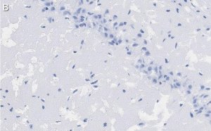 Anti-PSD95 Antibody, clone K28/43 ZooMAb Mouse Monoclonal 
