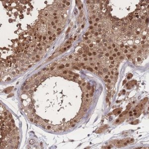 Anti-PSMA1 antibody produced in rabbit HPA043891-100UL