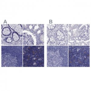 Anti-PSMB11 antibody produced in rabbit 