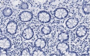 Anti-PSMB2 Antibody, clone 2N18 ZooMAb Rabbit Monoclonal 