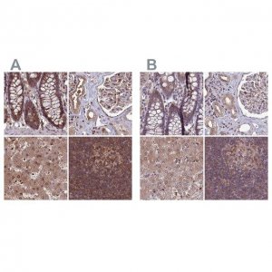 Anti-PSMB8 antibody produced in rabbit HPA046995-100UL