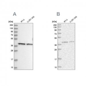 Anti-PSMD13 antibody produced in rabbit 