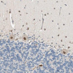 Anti-PSMD8 antibody produced in rabbit HPA006702-100UL