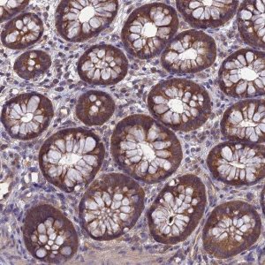 Anti-PSMF1 antibody produced in rabbit 