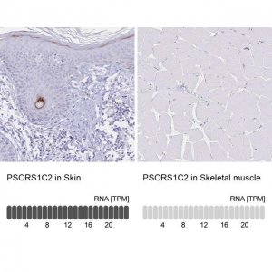 Anti-PSORS1C2 antibody produced in rabbit 