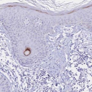 Anti-PSORS1C2 antibody produced in rabbit 