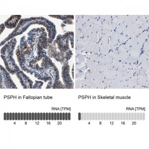 Anti-PSPH antibody produced in rabbit 