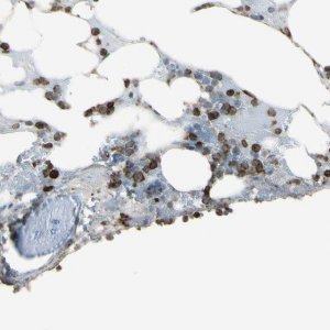 Anti-PSTPIP1 antibody produced in rabbit 