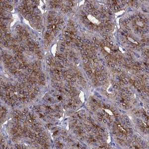 Anti-PTH antibody produced in rabbit 