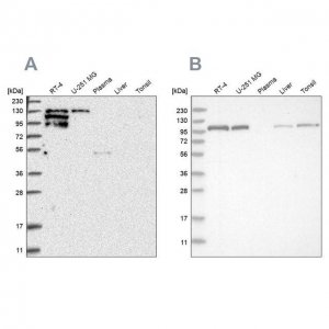 Anti-PTK2B antibody produced in rabbit 