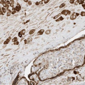 Anti-PTK6 antibody produced in rabbit 