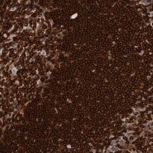 Anti-PTPN6 antibody produced in rabbit 
