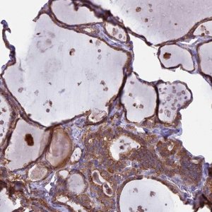 Anti-PTPN9 antibody produced in rabbit 