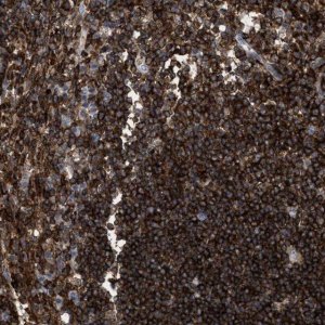 Anti-PTPRE antibody produced in rabbit HPA021872-100UL