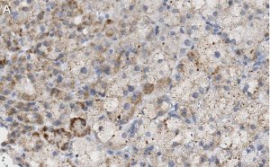 Anti-PTRH1 Antibody, clone 3O6 ZooMAb Rabbit Monoclonal 