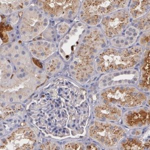 Anti-PTS antibody produced in rabbit 