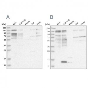 Anti-PUM1 antibody produced in rabbit 