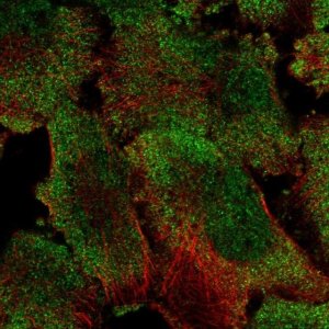 Anti-PUM1 antibody produced in rabbit 