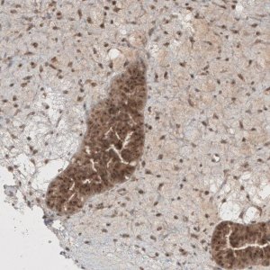Anti-PUM3 antibody produced in rabbit 