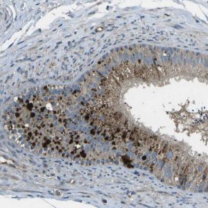 Anti-PXYLP1 antibody produced in rabbit 