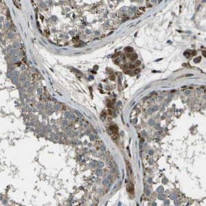 Anti-PXYLP1 antibody produced in rabbit 