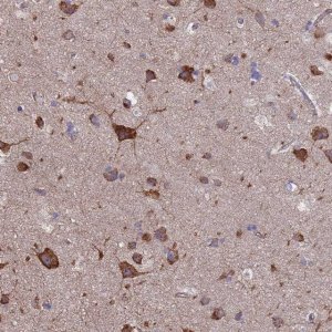 Anti-PYCR1 antibody produced in rabbit 