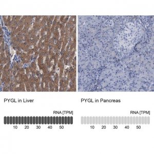 Anti-PYGL antibody produced in rabbit 