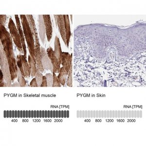 Anti-PYGM antibody produced in rabbit 