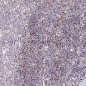 Anti-PYHIN1 antibody produced in rabbit 