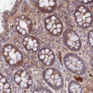 Anti-PYM1 antibody produced in rabbit 