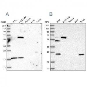 Anti-PYROXD2 antibody produced in rabbit 