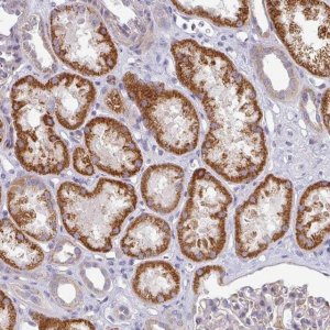 Anti-PYROXD2 antibody produced in rabbit 