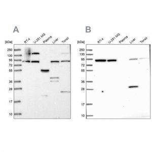 Anti-QARS antibody produced in rabbit 