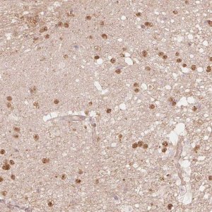 Anti-QDPR antibody produced in rabbit 