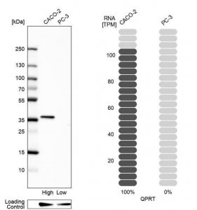 Anti-QPRT antibody produced in rabbit 