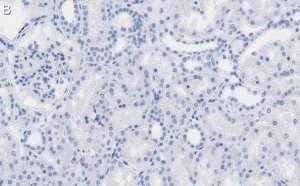 Anti-QPRTase Antibody, clone 1G22 ZooMAb Rabbit Monoclonal 